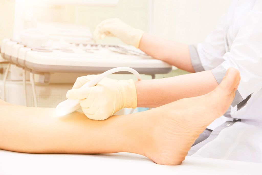 Doctor in a clinic performing an ultrasound scan on a patient's lower leg to check for vein health.
